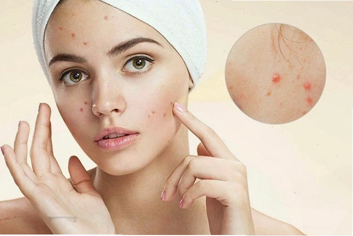 Ứng dụng của Lưu huỳnh trong làm đẹp