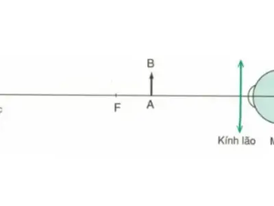 Lý thuyết mắt cận và mắt lão